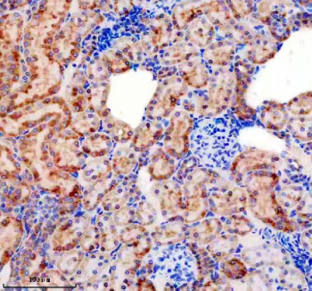 Immunohistochemical staining of FFPE rat kidney tissue with Sonic Hedgehog antibody, HRP-secondary and DAB substrate. HIER: boil tissue sections in pH8 EDTA for 20 min and allow to cool before testing.