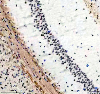 Phospho-SIRT1 (pSer47) Antibody Mouse Brain IHC. Immunohistochemical staining of FFPE mouse brain tissue with Phospho-Sirtuin 1 (pSer47) antibody, HRP-secondary and DAB substrate. HIER: boil tissue sections in pH8 EDTA for 20 min and allow to cool before testing.