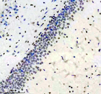 Phospho-SIRT1 (pSer47) Antibody Rat Brain IHC. Immunohistochemical staining of FFPE rat brain tissue with Phospho-Sirtuin 1 (pSer47) antibody, HRP-secondary and DAB substrate. HIER: boil tissue sections in pH8 EDTA for 20 min and allow to cool before testing.