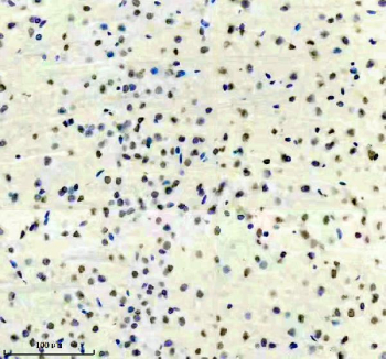 Phospho-SIRT1 (pSer47) Antibody Rat Brain Immunohistochemistry. IHC staining of FFPE rat brain tissue with Phospho-Sirtuin 1 (pSer47) antibody, HRP-secondary and DAB substrate. HIER: boil tissue sections in pH8 EDTA for 20 min and allow to cool before testing.