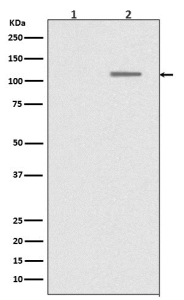 Phospho-SIRT1 (pSer47) Antibody HEK293 WB. Western blot analysis of phospho-SIRT1 expression in Lane 1: HEK293 cell lysate and Lane 2: lambda phosphatase-treated HEK293 cell lysate using Phospho-SIRT1 (pSer47) Antibody / DNA Damage Response Marker. A phospho-specific band is detected at approximately 110-120 kDa corresponding to phosphorylated Sirtuin 1 / SIRT1 at Ser47. Reduction of signal following phosphatase treatment supports phosphorylation-dependent recognition of SIRT1 associated with stress-response and DNA damage signaling pathways.