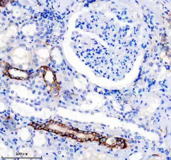 Immunohistochemical staining of FFPE human kidney tissue with NCAM-L1 antibody, HRP-secondary and DAB substrate. HIER: boil tissue sections in pH8 EDTA for 20 min and allow to cool before testing.