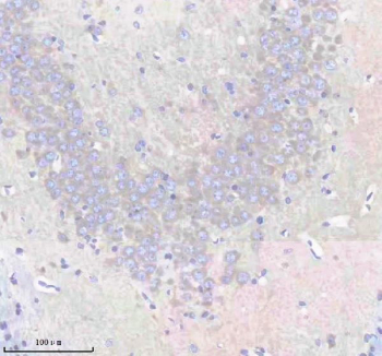 Immunohistochemical staining of FFPE mouse brain tissue with EEA1 antibody, HRP-secondary and DAB substrate. HIER: boil tissue sections in pH8 EDTA for 20 min and allow to cool before testing.