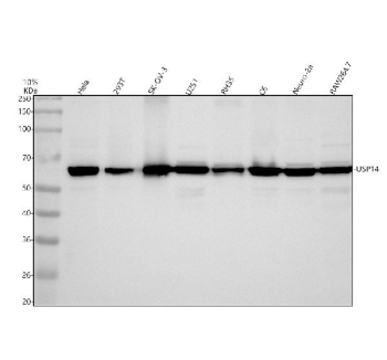 Western blot analysis of USP14 expression in human HeLa, 293T, SK-OV-3, U251, rat RH35 and C6, and mosue Neuro-2a, and RAW264.7 cell lysates using USP14 antibody. A specific band is detected at approximately 60 kDa, consistent with the reported electrophoretic mobility of Ubiquitin carboxyl-terminal hydrolase 14.