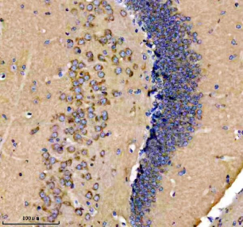 Immunohistochemical staining of FFPE mouse brain tissue with Glutamate Receptor 2 antibody, HRP-secondary and DAB substrate. HIER: boil tissue sections in pH8 EDTA for 20 min and allow to cool before testing.