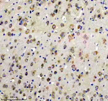 Immunohistochemical staining of FFPE rat brain tissue with Glutamate Receptor 2 antibody, HRP-secondary and DAB substrate. HIER: boil tissue sections in pH8 EDTA for 20 min and allow to cool before testing.