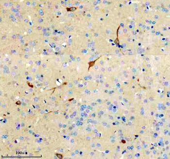 Immunohistochemical staining of FFPE rat brain tissue with NCR2 antibody, HRP-secondary and DAB substrate. HIER: boil tissue sections in pH8 EDTA for 20 min and allow to cool before testing.