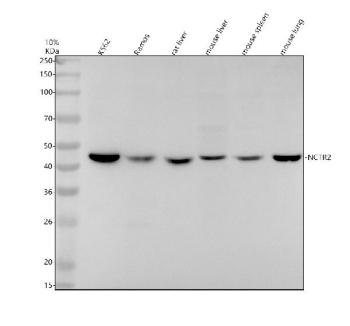 Western blot analysis of NCR2 expression using anti-NCR2 antibody. Lysates include human K562 cells, human Ramos cells, rat liver tissue, mouse liver tissue, mouse spleen tissue, and mouse lung tissue. A specific band is detected at approximately 40-45 kDa. NCR2 has a predicted molecular weight of ~31 kDa; however, the mature protein is a glycosylated cell surface receptor and may be observed at higher apparent molecular weights, up to ~44 kDa, due to N-linked glycosylation.