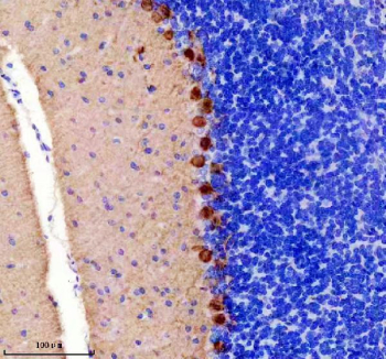 Immunohistochemical staining of mouse cerebellum using PRKCG antibody, HRP-secondary and DAB substrate. HIER: boil tissue sections in pH8 EDTA for 20 min and allow to cool before testing. Protein kinase C gamma shows strong cytoplasmic staining in Purkinje neurons localized to the Purkinje cell layer, with minimal staining in the surrounding granular layer.