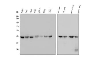 Western blot analysis of GNAQ using anti-GNAQ antibody. Samples include human Jurkat, HeLa, A549, A431, MCF-7, K562, and monkey COS7 cell lysates, as well as rat brain tissue lysate, rat lung tissue lysate, mouse brain tissue lysate, and mouse lung tissue lysate. Guanine nucleotide binding protein Gq subunit alpha has a predicted molecular weight of approximately 42 kDa and is observed as a primary band at approximately 42 kDa across all samples. In some lysates, GNAQ appears as a closely spaced doublet, which can be attributed to differential post-translational modifications such as phosphorylation or variable lipid modification states that alter electrophoretic mobility without changing core protein size.