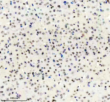 Immunohistochemical staining of FFPE mouse brain tissue using ADAR antibody, HRP-secondary and DAB substrate. HIER: boil tissue sections in pH8 EDTA for 20 min and allow to cool before testing.