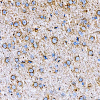 Immunohistochemical staining of FFPE rat brain tissue with RAB7A antibody, HRP-secondary and DAB substrate. HIER: boil tissue sections in pH8 EDTA for 20 min and allow to cool before testing.