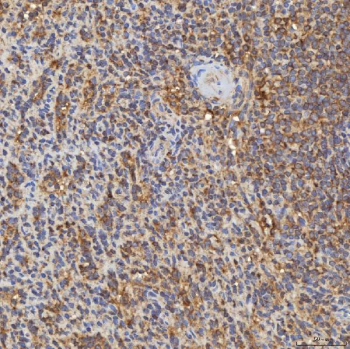 Immunohistochemical staining of FFPE human spleen tissue with RAB7A antibody, HRP-secondary and DAB substrate. HIER: boil tissue sections in pH8 EDTA for 20 min and allow to cool before testing.
