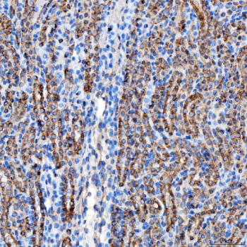 Immunohistochemical staining of FFPE mouse kidney tissue with RAB7A antibody, HRP-secondary and DAB substrate. HIER: boil tissue sections in pH8 EDTA for 20 min and allow to cool before testing.
