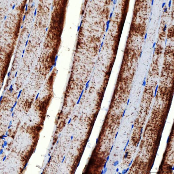 Immunohistochemical staining of FFPE mouse skeletal muscle tissue with RAB7A antibody, HRP-secondary and DAB substrate. HIER: boil tissue sections in pH8 EDTA for 20 min and allow to cool before testing.