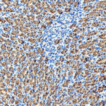 Immunohistochemical staining of FFPE rat kidney tissue with RAB7A antibody, HRP-secondary and DAB substrate. HIER: boil tissue sections in pH8 EDTA for 20 min and allow to cool before testing.
