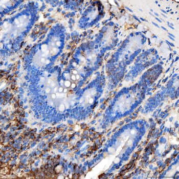 Immunohistochemical staining of FFPE rat colon tissue with RAB7A antibody, HRP-secondary and DAB substrate. HIER: boil tissue sections in pH8 EDTA for 20 min and allow to cool before testing.