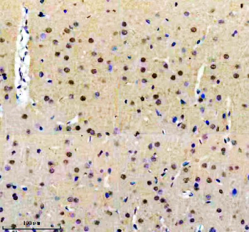 Immunohistochemical staining of FFPE rat brain tissue using HIV Tat-specific factor 1 antibody, HRP-secondary and DAB substrate. HIER: boil tissue sections in pH8 EDTA for 20 min and allow to cool before testing.