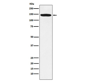 Western blot analysis using HIV Tat-specific factor 1 antibody. Lane 1: human Jurkat whole cell lysate. The predicted molecular weight of HIV Tat-specific factor 1 (HTATSF1) is ~86 kDa, while HIV Tat-specific factor 1 antibody detects a prominent band at ~140 kDa on SDS-PAGE, consistent with the commonly reported apparent migration of Tat-SF1 as an approximately 130-140 kDa phosphorylated protein.