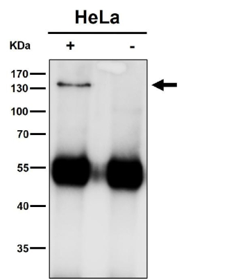 Immunoprecipitation of HIV Tat-specific factor 1 protein from 500ug of human HeLa whole cell lysate with 2ug of HIV Tat-specific factor 1 antibody. The predicted molecular weight of HIV Tat-specific factor 1 (HTATSF1) is ~86 kDa, while HIV Tat-specific factor 1 antibody detects a band at ~140 kDa on SDS-PAGE, consistent with the commonly reported apparent migration of Tat-SF1 as an approximately 130-140 kDa phosphorylated protein.