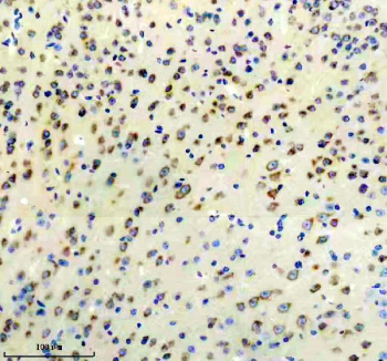 Immunohistochemical staining using DKK3 antibody on paraffin-embedded mouse brain tissue sections. Heat-induced epitope retrieval was performed using EDTA buffer (pH 8.0) prior to antibody incubation. Sections were blocked with 10% goat serum and incubated with DKK3 antibody overnight at 4C. Detection was carried out using an HRP-based secondary antibody with DAB as the chromogen. Staining demonstrates cytoplasmic immunoreactivity in brain tissue. Nuclei were counterstained with hematoxylin.