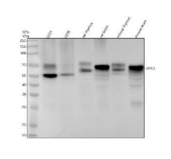 Western blot analysis using DKK3 antibody. Lane 1: human U251 whole cell lysate; Lane 2: human U2OS whole cell lysate; Lane 3: rat thymus tissue lysate; Lane 4: rat brain tissue lysate; Lane 5: mouse thymus tissue lysate; Lane 6: mouse brain tissue lysate. The predicted molecular weight of DKK3 is ~38 kDa, while DKK3 antibody detects bands migrating between approximately 50 and 70 kDa on SDS-PAGE, consistent with post-translationally modified and mature forms of Dickkopf-related protein 3.