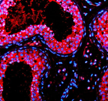 Immunofluorescence staining using PRND antibody on paraffin-embedded human testis tissue sections. Heat-induced epitope retrieval was performed using EDTA buffer (pH 8.0) prior to antibody incubation. Sections were blocked with 10% goat serum and incubated with PRND antibody overnight at 4C. Fluorescent signal was detected using a Cy3-conjugated secondary antibody, and nuclei were counterstained with DAPI. Staining highlights PRND expression within cells of the seminiferous tubules.