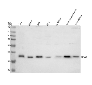 Western blot analysis of Programmed cell death protein 6 using PDCD6 antibody. Lane 1: human HeLa whole cell lysates; Lane 2: human MCF-7 whole cell lysates; Lane 3: human SiHa whole cell lysates; Lane 4: human PC-3 whole cell lysates; Lane 5: rat kidney tissue lysates; Lane 6: mouse small intestine tissue lysates; Lane 7: mouse kidney tissue lysates. A predominant band is detected at approximately 17 kDa across multiple samples. Although the predicted molecular weight of PDCD6 is ~22 kDa, PDCD6 is known to migrate at a lower apparent molecular weight on SDS-PAGE, likely due to its compact structure and calcium-binding EF-hand domains. The observed banding pattern is consistent with detection of PDCD6 in both human and rodent samples.
