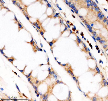 Immunohistochemistry analysis of Phosphodiesterase 4A using PDE4A antibody. Phosphodiesterase 4A expression was examined in a paraffin-embedded section of human colon tissue. Heat-mediated antigen retrieval was performed using EDTA buffer (pH 8.0). Tissue sections were blocked with normal goat serum and incubated with PDE4A antibody overnight at 4Â°C. Immunoreactivity was visualized using an HRP-based detection system with DAB chromogen, followed by hematoxylin counterstaining.
