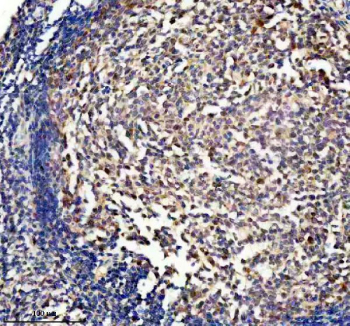 Immunohistochemistry of DUSP2 in human tonsil tissue. DUSP2 expression was examined in a paraffin-embedded section of human tonsil. Heat-mediated antigen retrieval was performed in EDTA buffer (pH 8.0). After blocking with normal serum, the section was incubated with an anti-DUSP2 antibody, followed by an HRP-conjugated secondary antibody and DAB chromogen. Brown staining indicates DUSP2 immunoreactivity, with hematoxylin counterstaining highlighting tissue architecture.