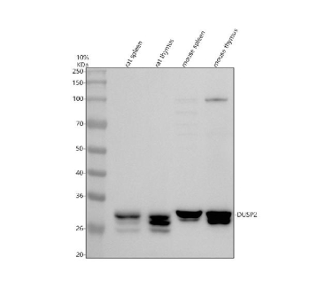 Immunofluorescence analysis of Phosphodiesterase 4A using PDE4A antibody. Phosphodiesterase 4A expression was examined in a paraffin-embedded section of human colon cancer tissue. Heat-mediated antigen retrieval was performed using EDTA buffer (pH 8.0). Tissue sections were blocked with normal goat serum and incubated with PDE4A antibody overnight at 4Â°C. Detection was performed using a fluorescently labeled secondary antibody, and nuclei were counterstained with DAPI. Fluorescent images were acquired using appropriate filter sets.