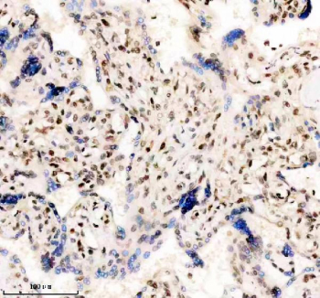 Immunohistochemical staining of FFPE human placental tissue with TBX5 antibody, HRP-secondary and DAB substrate. HIER: boil tissue sections in pH8 EDTA for 20 min and allow to cool before testing.
