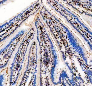 Immunohistochemical staining of FFPE mouse intestine tissue with TBX5 antibody, HRP-secondary and DAB substrate. HIER: boil tissue sections in pH8 EDTA for 20 min and allow to cool before testing.