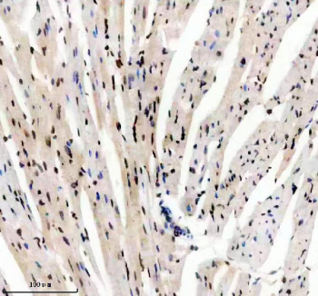 Immunohistochemical staining of FFPE mouse heart tissue with TBX5 antibody, HRP-secondary and DAB substrate. HIER: boil tissue sections in pH8 EDTA for 20 min and allow to cool before testing.