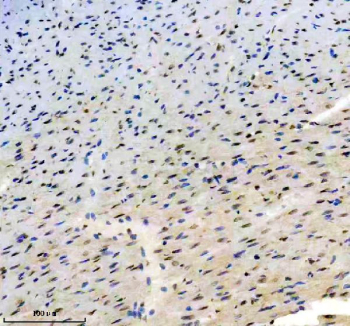 Immunohistochemical staining of FFPE rat heart tissue with TBX5 antibody, HRP-secondary and DAB substrate. HIER: boil tissue sections in pH8 EDTA for 20 min and allow to cool before testing.
