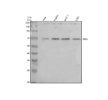 Western blot analysis of TBX5 using anti-TBX5 antibody. Human whole cell lysates from HeLa, HepG2, MCF-7, and U2OS cells were resolved by 10% SDS-PAGE under reducing conditions and transferred to a nitrocellulose membrane. TBX5 was detected as a prominent band migrating at approximately 65-70 kDa across all tested cell lines. The predicted molecular weight of TBX5 based on amino acid sequence is approximately 58 kDa; the higher apparent molecular weight observed on SDS-PAGE is consistent with reported behavior of T-box transcription factors and may reflect post-translational modifications, altered SDS binding, or conformational properties that affect electrophoretic mobility rather than a difference in primary sequence.