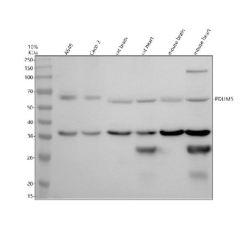 Western blot analysis of PDLIM5 using anti-PDLIM5 antibody. PDLIM5 antibody detects a prominent band at approximately 64 kDa, consistent with the predicted molecular weight of full-length PDZ and LIM domain protein 5. Additional lower-molecular-weight bands at approximately 37 kDa and around 30 kDa are observed, particularly in heart tissue, which are consistent with reported PDLIM5 isoforms and tissue-specific processing described for this protein. Samples were resolved by 10% SDS-PAGE under reducing conditions and transferred to a nitrocellulose membrane. Lane 1: human A549 whole cell lysates; Lane 2: human Caco-2 whole cell lysates; Lane 3: rat brain tissue lysates; Lane 4: rat heart tissue lysates; Lane 5: mouse brain tissue lysates; Lane 6: mouse heart tissue lysates. Detection was performed using HRP-based chemiluminescence.