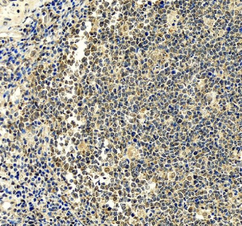 IHC analysis of UBXN1 in human tonsil tissue. UBXN1 expression was examined in a paraffin-embedded section of human tonsil tissue using immunohistochemistry. Heat-mediated antigen retrieval was performed in EDTA buffer (pH 8.0). Sections were blocked with 10% goat serum and incubated with a rabbit anti-UBXN1 antibody overnight at 4Â°C. Detection was performed using an HRP-conjugated secondary antibody with DAB chromogen, and nuclei were counterstained with hematoxylin. UBXN1 staining is observed primarily in lymphoid cells with a cytoplasmic distribution.