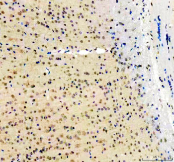 IHC analysis of UBXN1 in mouse brain tissue. UBXN1 expression in mouse brain tissue was assessed using immunohistochemistry on paraffin-embedded sections. Antigen retrieval was performed using EDTA buffer (pH 8.0), and sections were blocked with 10% goat serum before overnight incubation with a rabbit anti-UBXN1 antibody at 4Â°C. Signal was visualized using an HRP-conjugated secondary antibody and DAB chromogen, with hematoxylin counterstaining. UBXN1 staining is observed in neuronal cell populations.