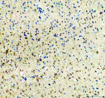 IHC analysis of UBXN1 in rat brain tissue. Paraffin-embedded rat brain tissue sections were stained for UBXN1 using immunohistochemistry. Heat-mediated antigen retrieval was conducted in EDTA buffer (pH 8.0), followed by blocking with 10% goat serum. Sections were incubated with a rabbit anti-UBXN1 antibody overnight at 4Â°C. Detection was achieved using an HRP-conjugated secondary antibody with DAB chromogen and hematoxylin counterstaining. UBXN1 immunoreactivity is present in neural tissue.