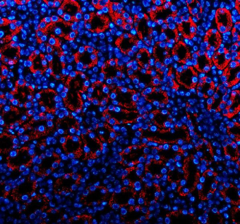 Immunofluorescence analysis of Platelet-derived growth factor D using PDGF-D antibody. Platelet-derived growth factor D expression was examined in a paraffin-embedded section of mouse kidney tissue. Heat-mediated antigen retrieval was performed using EDTA buffer (pH 8.0). Tissue sections were blocked with normal goat serum and incubated with PDGF-D antibody (red) overnight at 4C. Immunoreactivity was visualized using fluorescence detection, and nuclei were counterstained with DAPI (blue).