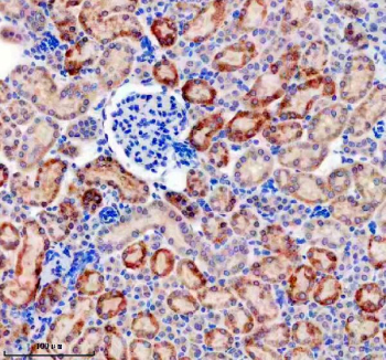 Immunohistochemistry analysis of Platelet-derived growth factor D using PDGF-D antibody. Platelet-derived growth factor D expression was examined in a paraffin-embedded section of mouse kidney tissue. Heat-mediated antigen retrieval was performed using EDTA buffer (pH 8.0). Tissue sections were blocked with normal goat serum and incubated with PDGF-D antibody overnight at 4C. Immunoreactivity was visualized using an HRP-based detection system with DAB chromogen, followed by hematoxylin counterstaining.