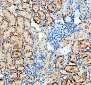 Immunohistochemistry analysis of Platelet-derived growth factor D using PDGF-D antibody. Platelet-derived growth factor D expression was examined in a paraffin-embedded section of rat kidney tissue. Heat-mediated antigen retrieval was performed using EDTA buffer (pH 8.0). Tissue sections were blocked with normal goat serum and incubated with PDGF-D antibody overnight at 4C. Immunoreactivity was visualized using an HRP-based detection system with DAB chromogen, followed by hematoxylin counterstaining.