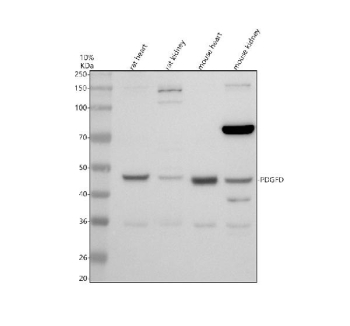 Western blot analysis of PDGFD using PDGFD antibody.Protein lysates from rat heart (Lane 1), rat kidney (Lane 2), mouse heart (Lane 3), and mouse kidney (Lane 4) were resolved by SDS-PAGE under reducing conditions and transferred to a nitrocellulose membrane. PDGFD was detected as a major band at approximately 43 kDa, corresponding to the predicted molecular weight of the latent monomeric form of Platelet-derived growth factor D. A weaker band at approximately 35 kDa is consistent with proteolytically processed, active PDGFD, while a higher molecular weight band near 75 kDa is consistent with dimeric or incompletely reduced PDGFD species. Detection was performed using an HRP-based secondary antibody and chemiluminescent substrate.