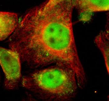 Immunofluorescence analysis of UCHL3 using UCHL3 antibody and Alpha Tubulin antibody. UCHL3 expression was examined in cultured HeLa cells. Enzymatic antigen retrieval was performed prior to staining. Cells were blocked with normal goat serum and incubated with UCHL3 antibody (green) and Alpha Tubulin antibody (red) overnight at 4C. Immunoreactivity was visualized by fluorescence microscopy, showing UCHL3 localization in both the cytoplasm and nucleus, while Alpha Tubulin highlights the cytoskeletal network.