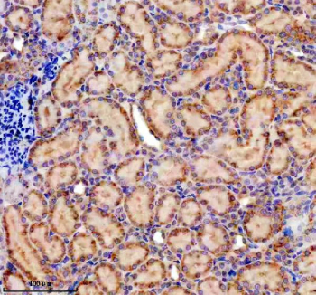 Immunohistochemistry analysis of Protein pelota homolog using PELO antibody. PELO expression was examined in a paraffin-embedded section of rat kidney tissue. Heat-mediated antigen retrieval was performed using EDTA buffer (pH 8.0). Tissue sections were blocked with normal goat serum and incubated with PELO antibody overnight at 4C. Immunoreactivity is observed predominantly in renal tubular epithelial cells, with minimal staining in surrounding stromal areas. Detection was visualized using an HRP-based detection system with DAB chromogen, followed by hematoxylin counterstaining.