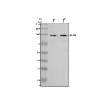 Western blot analysis of PDE8B using PDE8B antibody. Protein lysates from human HeLa cells (Lane 1) and human SiHa cells (Lane 2) were resolved by SDS-PAGE under reducing conditions and transferred to a nitrocellulose membrane. PDE8B was detected as a band at approximately 99 kDa, consistent with the predicted molecular weight of Phosphodiesterase 8B. Detection was performed using an HRP-based secondary antibody and chemiluminescent substrate.
