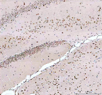 Immunohistochemistry analysis of MECP2 using Methyl-CpG-binding protein 2 antibody. MECP2 expression was examined in rat brain tissue, showing nuclear localization in neuronal cell populations. Heat-mediated antigen retrieval was performed using EDTA buffer (pH 8.0). Tissue sections were blocked with normal goat serum and incubated with MECP2 antibody overnight at 4Â°C. Immunoreactivity was visualized using an HRP-based detection system with DAB chromogen, followed by hematoxylin counterstaining.