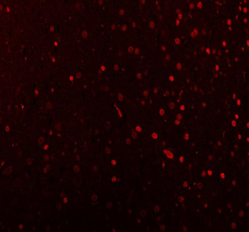 Immunofluorescence analysis of MECP2 using Methyl-CpG-binding protein 2 antibody. MECP2 expression was examined in rat brain tissue, showing nuclear localization within neuronal populations. Heat-mediated antigen retrieval was performed using EDTA buffer (pH 8.0). Tissue sections were blocked with normal goat serum and incubated with MECP2 antibody (red) overnight at 4Â°C. Immunoreactivity was visualized using fluorescence detection.