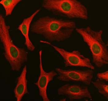 DUT Antibody HeLa Cell IF. Immunofluorescent staining of human HeLa cells using DUT antibody demonstrates predominant nuclear localization of Deoxyuridine Triphosphatase (DUT), shown in green, consistent with its role in regulating nucleotide pools and maintaining DNA replication fidelity. DUT is a genome integrity enzyme that prevents inappropriate uracil incorporation into DNA and supports genomic stability during cellular proliferation. Co-staining with alpha tubulin (red) highlights the cytoplasmic microtubule network and provides contrast to the nuclear distribution of DUT. The observed staining pattern is consistent with the established function of DUT in nucleotide metabolism, genome maintenance, and DNA integrity pathways. Alpha tubulin was used as a cytoplasmic marker.